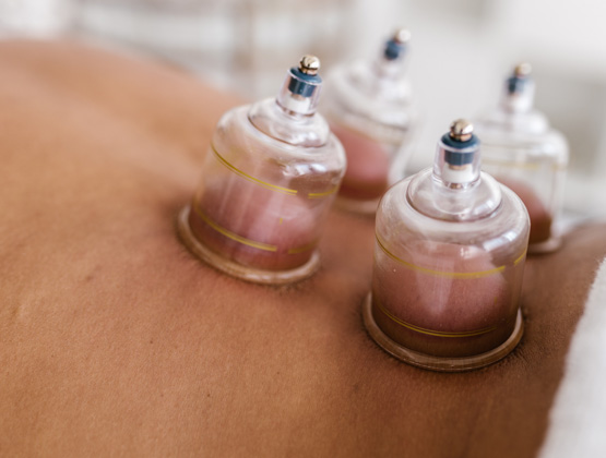 cupping